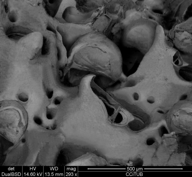 Avicularia-Ovicell complex
